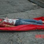 Examination and autopsy of Chinese woman with skull fracture