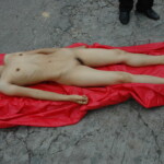 Chinese woman with skull fracture