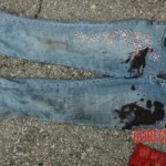 Examination and autopsy of Chinese woman with skull fracture