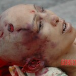 Examination and autopsy of Chinese woman with skull fracture