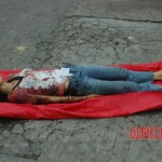 Examination and autopsy of Chinese woman with skull fracture