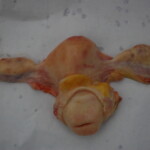 Chinese woman with skull fracture