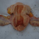 Chinese woman with skull fracture