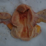 Chinese woman with skull fracture