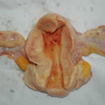 Chinese woman with skull fracture