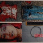 Chinese woman with skull fracture