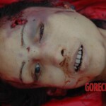 Examination and autopsy of Chinese woman with skull fracture