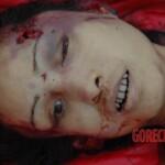 Chinese woman with skull fracture