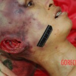 Examination and autopsy of Chinese woman with skull fracture