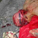 Examination and autopsy of Chinese woman with skull fracture