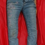 Chinese woman with skull fracture