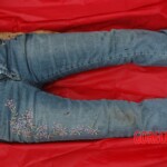 Examination and autopsy of Chinese woman with skull fracture