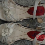 Chinese woman with skull fracture