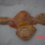 Examination and autopsy of Chinese woman with skull fracture