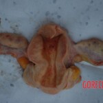 Examination and autopsy of Chinese woman with skull fracture