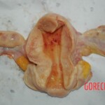 Examination and autopsy of Chinese woman with skull fracture