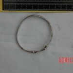 Chinese woman with skull fracture