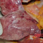 Examination and autopsy of Chinese woman with skull fracture