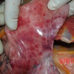 Examination and autopsy of Chinese woman with skull fracture