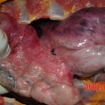Examination and autopsy of Chinese woman with skull fracture