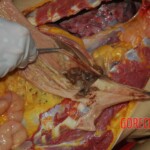 Examination and autopsy of Chinese woman with skull fracture