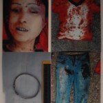 Examination and autopsy of Chinese woman with skull fracture