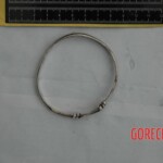 Examination and autopsy of Chinese woman with skull fracture