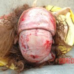 Autopsy of raped Chinese woman