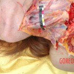 Autopsy of raped Chinese woman