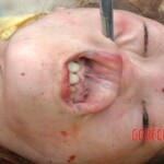 Autopsy of raped Chinese woman