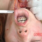 Autopsy of raped Chinese woman