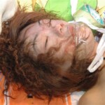 Autopsy of raped Chinese woman