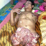 Crocodile attack in Indonesia