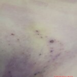 Hanged teen girl in morgue