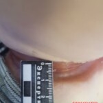 Hanged teen girl in morgue