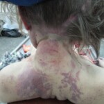 Hanged blonde in morgue