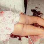 Vintage photo of dead woman
