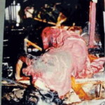 Vintage photo of dead woman