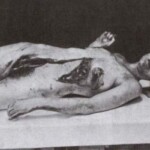 Vintage photo of dead woman