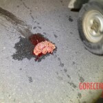 Motorcyclist's brain splattered on the road