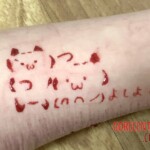 Shoushuii self-harm
