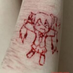 Shoushuii self-harm