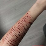 Shoushuii self-harm
