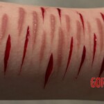 Shoushuii self-harm