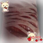 Self-harm of transgender boy