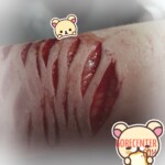 Self-harm of transgender boy