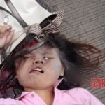 Woman with cracked skull