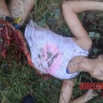 Ukrainian beauty ripped by bomb blast
