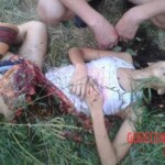 Ukrainian beauty ripped by bomb blast