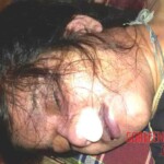 Strangled to death in ferry